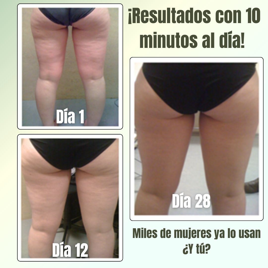 SlimLeggys - Piernas SIN CELULITIS ni Retención!